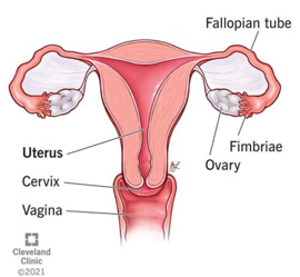 Hysterectomy Options